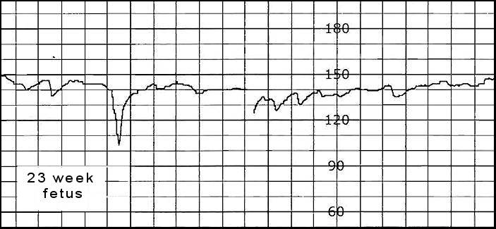 FHR 23 weeks