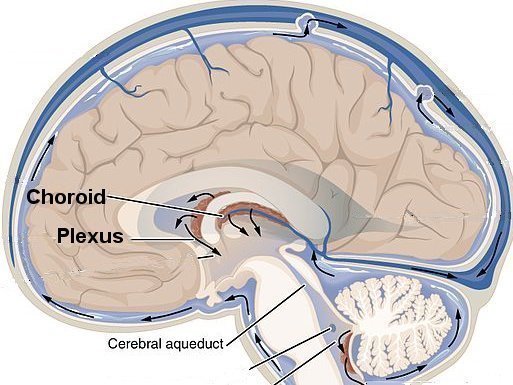 choroid plexus cyst symptoms