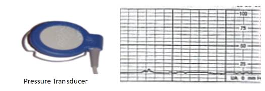 Pressure transducer