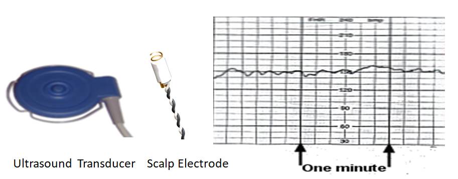 FHR Transducer