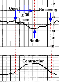 How To Read A Contraction Chart